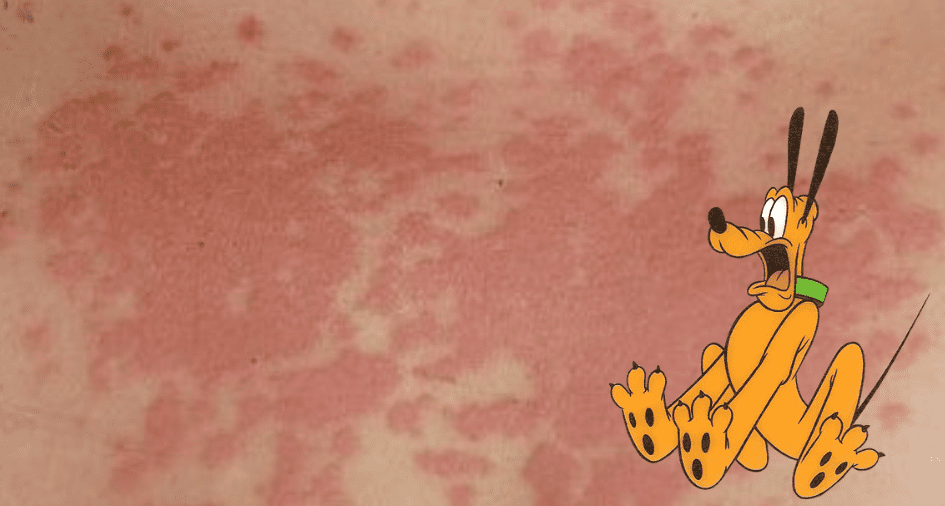 Disney Rash Cover Image